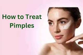 How to Treat Pimples: Methods for Having Clearer Skin