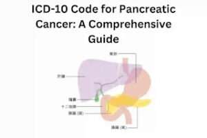 icd 10 code pancreatic cancer guide